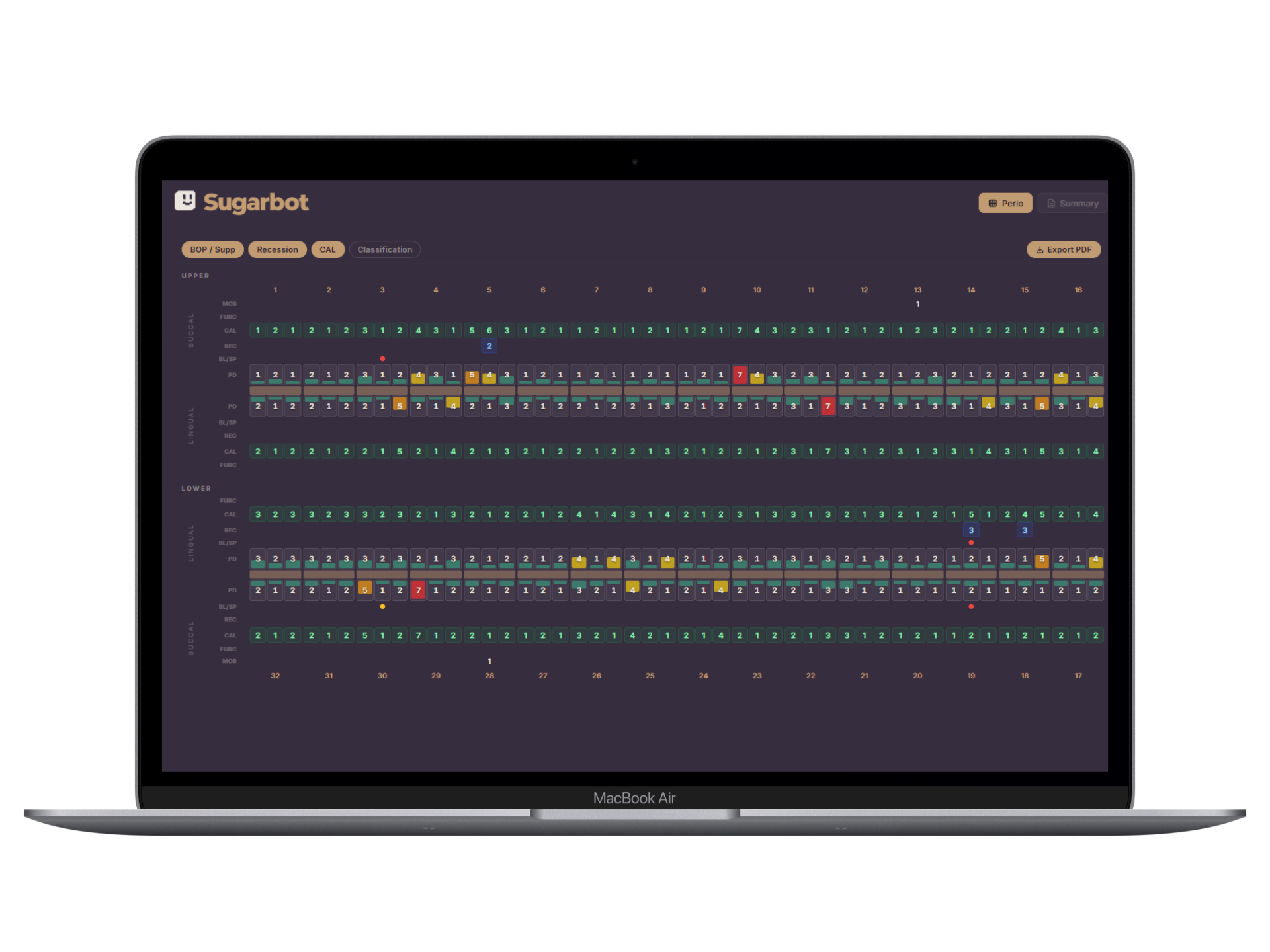 Sugarbot Voice Perio charting interface on a laptop