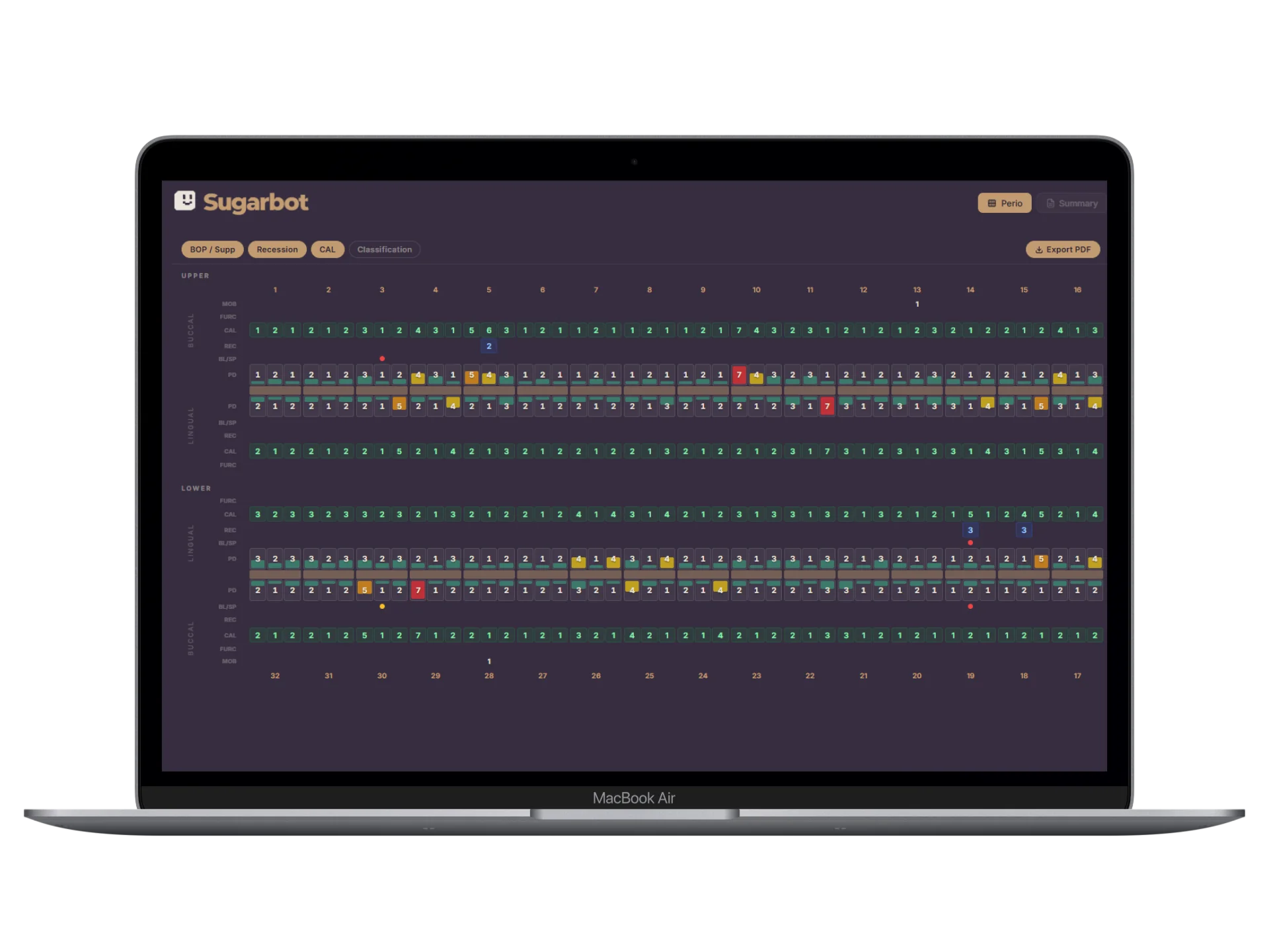 Sugarbot Voice Perio charting interface on a laptop